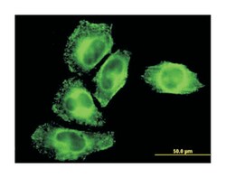 inhibitor of kappa light polypeptide gene enhancer in B-cells, kinase gamma, Mouse, Clone: 1D4, Abnova 100 &mu;g | Buy Online | Abnova Corporation | Fisher Scientific