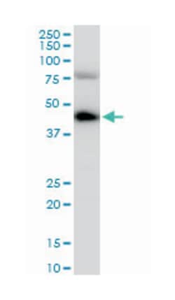 COP9 constitutive photomorphogenic homolog subunit 3 (Arabidopsis), Mouse,