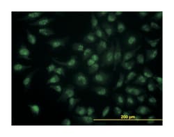 CDC14 cell division cycle 14 homolog A (S. cerevisiae), Mouse, Clone: 1F11,