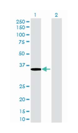 aldo-keto reductase family 7, member A2 (aflatoxin aldehyde reductase),