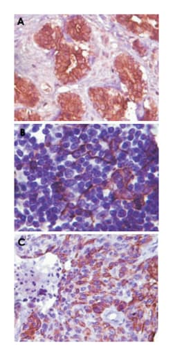 BLK, Mouse, Clone: 9D10D1, Abnova 100 &mu;L | Buy Online | Abnova | Fisher Scientific