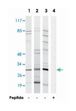 RPS8, Rabbit, Polyclonal Antibody, Abnova 100&mu;g; Unlabeled:Antibodies,