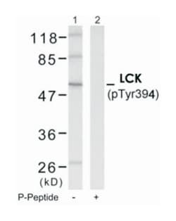 LCK (phospho Y394), Rabbit anti-Human, Mouse, Polyclonal Antibody, Abnova