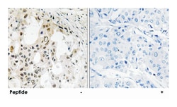 EIF3D, Rabbit, Polyclonal Antibody, Abnova 100 &mu;g | Buy Online | Abnova Corporation | Fisher Scientific
