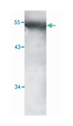 HEXIM1, Rabbit, Polyclonal Antibody, Abnova 100&mu;g; Unlabeled:Antibodies,