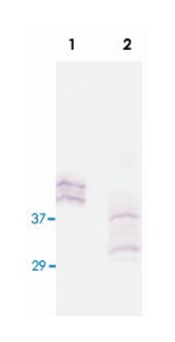 KLK14 Rabbit anti-Human, Polyclonal Antibody, Abnova 100&mu;g; Unlabeled:Antibodies,