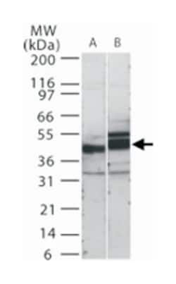 SIGIRR Rabbit anti-Human, Mouse, Polyclonal Antibody, Abnova 100&mu;g;