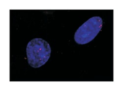RAD51 Rabbit anti-Chicken, Human, Mouse, Polyclonal Antibody, Abnova 50&mu;L;