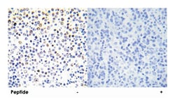 HIST1H3E Rabbit anti-Human, Mouse, Rat, Polyclonal Antibody, Abnova 100 &mu;g | Buy Online | Abnova Corporation | Fisher Scientific