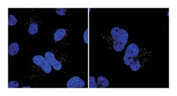 MIB1, Rabbit, Polyclonal Antibody, Abnova 400&mu;L; Unlabeled:Antibodies,