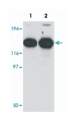 ZMYM2 Rabbit anti-Human, Mouse, Rat, Polyclonal Antibody, Abnova 100&mu;g;