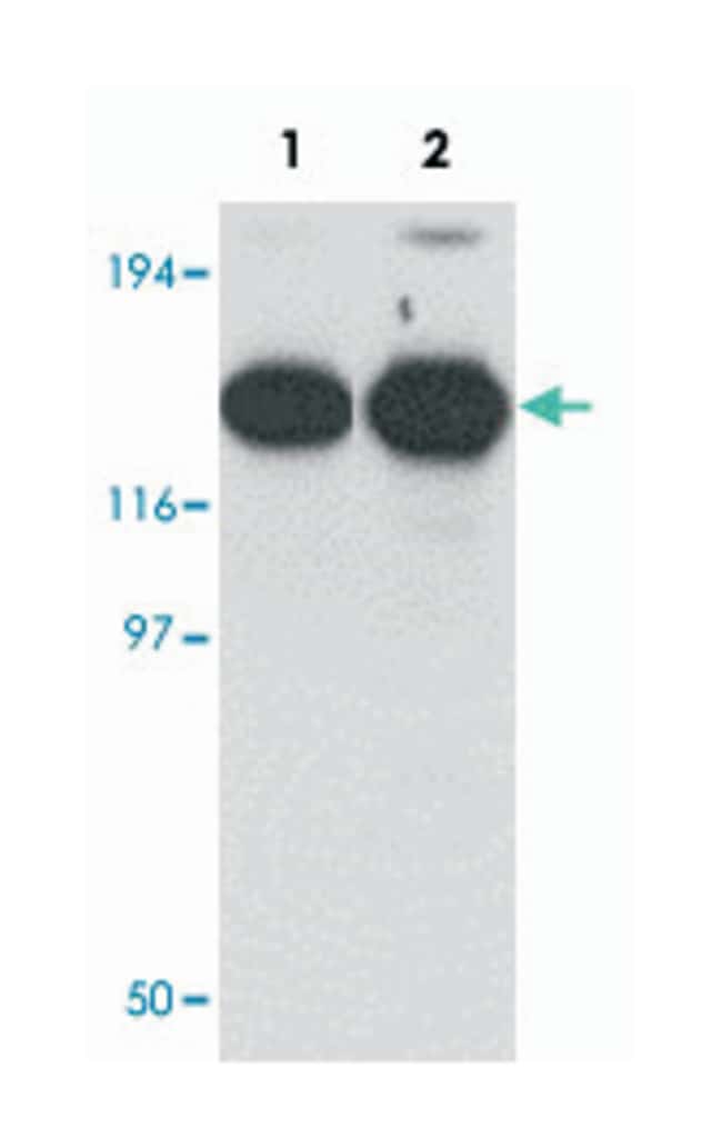 ANTI-ZMYM2 ANTIBODY 100UG