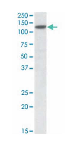 SIRT1, Goat, Polyclonal Antibody, Abnova 100 &mu;g | Buy Online | Abnova Corporation | Fisher Scientific