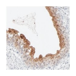 POF1B, Rabbit, Polyclonal Antibody, Abnova 100 &mu;L | Buy Online | Abnova Corporation | Fisher Scientific