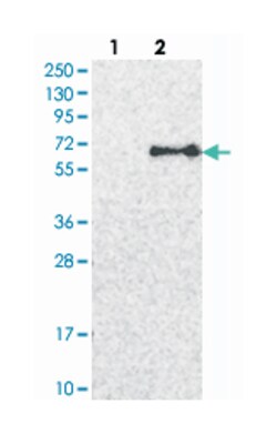 USP30, Rabbit, Polyclonal Antibody, Abnova 100 &mu;L | Buy Online | Abnova Corporation | Fisher Scientific