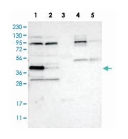 ABRA, Rabbit, Polyclonal Antibody, Abnova 100 &mu;L | Buy Online | Abnova Corporation | Fisher Scientific