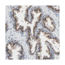 TMEM87A Rabbit anti-Human, Polyclonal Antibody, Abnova 100 &mu;L | Buy Online | Abnova Corporation | Fisher Scientific