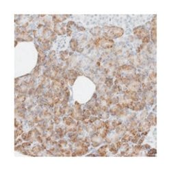 SPNS3, Rabbit, Polyclonal Antibody, Abnova 100 &mu;L | Buy Online | Abnova Corporation | Fisher Scientific