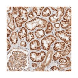 C9orf82 Rabbit anti-Human, Polyclonal Antibody, Abnova 100 &mu;L | Buy Online | Abnova Corporation | Fisher Scientific