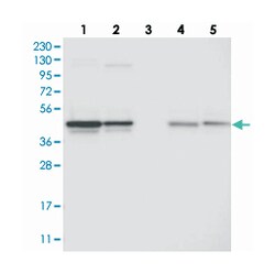 CCBL2 Rabbit anti-Human, Polyclonal Antibody, Abnova 100 &mu;L | Buy Online | Abnova Corporation | Fisher Scientific
