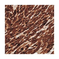 FREM2 Rabbit anti-Human, Polyclonal Antibody, Abnova 100 &mu;L | Buy Online | Abnova Corporation | Fisher Scientific