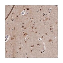 ZNF518B Rabbit anti-Human, Polyclonal Antibody, Abnova 100 &mu;L | Buy Online | Abnova Corporation | Fisher Scientific