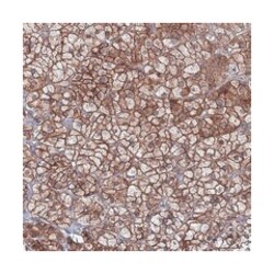 EXOC6, Rabbit, Polyclonal Antibody, Abnova 100&mu;L; Unlabeled:Antibodies,