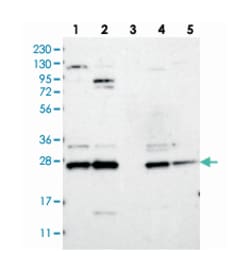 DCUN1D4 Rabbit anti-Human, Mouse, Rat, Polyclonal Antibody, Abnova 100 &mu;L | Buy Online | Abnova Corporation | Fisher Scientific
