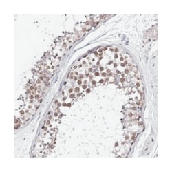 TEX12, Rabbit, Polyclonal Antibody, Abnova 100 &mu;L | Buy Online | Abnova Corporation | Fisher Scientific