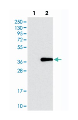 TXNDC14, Rabbit, Polyclonal Antibody, Abnova 100&mu;L; Unlabeled:Antibodies,
