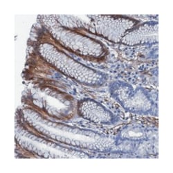 BCO2 Rabbit anti-Human, Polyclonal Antibody, Abnova 100 &mu;L | Buy Online | Abnova Corporation | Fisher Scientific