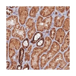 MPV17L, Rabbit, Polyclonal Antibody, Abnova 100 &mu;L | Buy Online | Abnova Corporation | Fisher Scientific