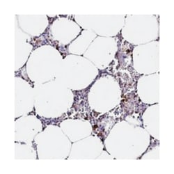 CLC, Rabbit, Polyclonal Antibody, Abnova 100&mu;L; Unlabeled:Antibodies,