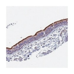 FAM166B, Rabbit, Polyclonal Antibody, Abnova 100 &mu;L | Buy Online | Abnova Corporation | Fisher Scientific