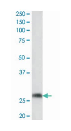 Ptgds, Goat, Polyclonal Antibody, Abnova 100 &mu;g | Buy Online | Abnova Corporation | Fisher Scientific