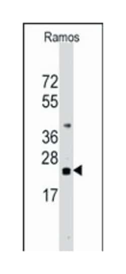 CD247 Rabbit anti-Human, Polyclonal Antibody, Abnova 400&mu;L; Unlabeled:Antibodies,
