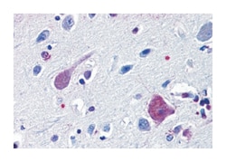 HTR2B Rabbit anti-Human, Monkey, Polyclonal Antibody, Abnova 50 &mu;g | Buy Online | Abnova Corporation | Fisher Scientific