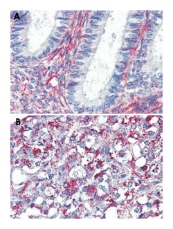 AGTR2 Rabbit anti-Bovine, Dog, Hamster, Horse, Human, Monkey, Mouse, Pig,