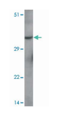 FOXH1, Rabbit, Polyclonal Antibody, Abnova 100&mu;g; Unlabeled:Antibodies,