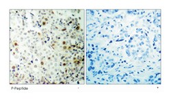 CDK2 (phospho T160), Rabbit anti-Human, Mouse, Rat, Polyclonal Antibody, Abnova 100 &mu;g | Buy Online | Abnova | Fisher Scientific