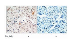 ERBB2 Rabbit anti-Human, Polyclonal Antibody, Abnova 100 &mu;g | Buy Online | Abnova Corporation | Fisher Scientific
