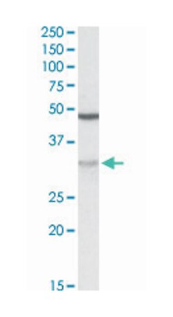 HCCA2, Goat, Polyclonal Antibody, Abnova 100 &mu;g | Buy Online | Abnova Corporation | Fisher Scientific