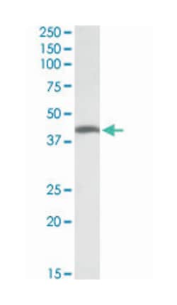 THNSL2, Goat, Polyclonal Antibody, Abnova 100&mu;g; Unlabeled:Antibodies,