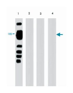 Vitellogenin (VTG), Mouse, Clone: 3E11, Abnova 100&mu;g; Unlabeled:Antibodies,