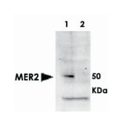 MER2 (phospho S30), Rabbit anti-Yeast, Polyclonal Antibody, Abnova 100&mu;g;