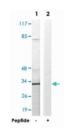 COX6C, Rabbit, Polyclonal Antibody, Abnova 100&mu;g; Unlabeled:Antibodies,