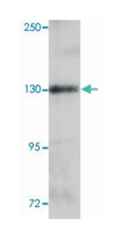 ZEB1, Rabbit, Polyclonal Antibody, Abnova 100&mu;g; Unlabeled:Antibodies,