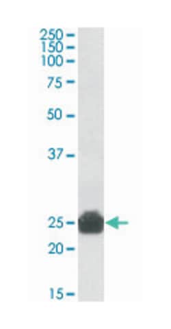 Yc2, Goat, Polyclonal Antibody, Abnova 100&mu;g; Unlabeled:Antibodies,