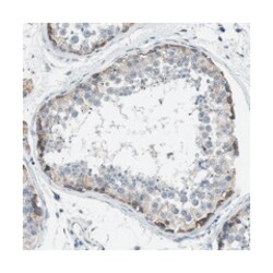 BNC2, Rabbit, Polyclonal Antibody, Abnova 100 &mu;L | Buy Online | Abnova Corporation | Fisher Scientific