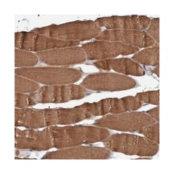 NARG1, Rabbit, Polyclonal Antibody, Abnova 100&mu;L; Unlabeled:Antibodies,